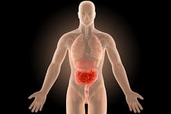 Crohn’s disease successfully treated with the paleolithic ketogenic diet